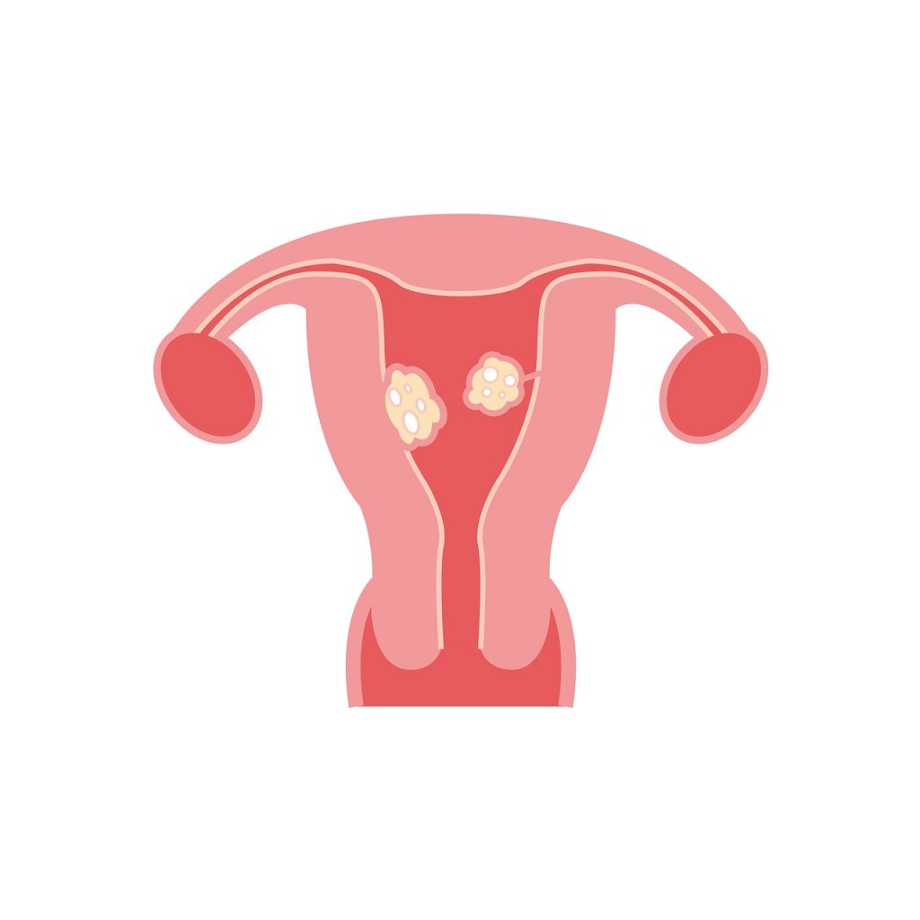 Cor do fluxo menstrual na Medicina Chinesa - Feminino Natural