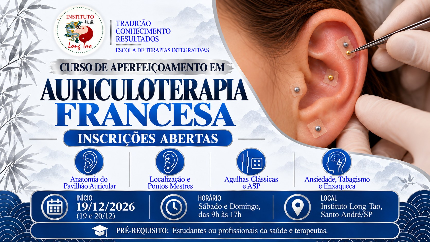 Auriculoterapia Francesa